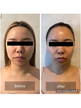 エクラ(Eclat)/Eclatの痩身★BeforeAfter7