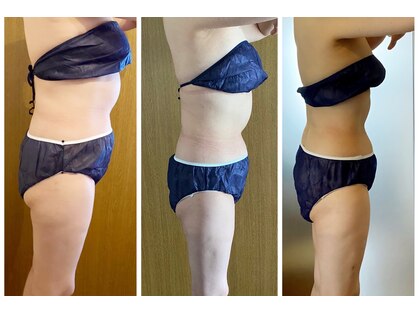 アリス 赤坂の写真