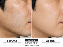 ボディステップ 調布(BODYSTEP)の雰囲気(頬/アゴ/顔/脱毛)