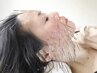人気No.1 インパクト大の鬼美容鍼施術◎ルート鬼美容鍼30分6500円→5000円