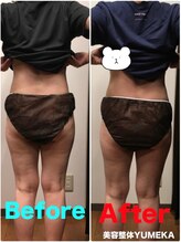美容整体ユメカ(美容整体YUMEKA)/骨盤ダイエット＋骨盤ストレッチ