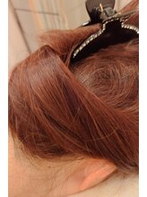 はる鍼灸整骨院/髪の悩み◇髪毛/育毛促進15回目