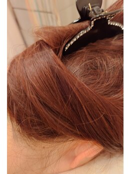 はる鍼灸整骨院/髪の悩み◇髪毛/育毛促進15回目