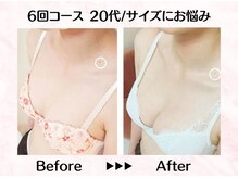 美人バスト リグラス(ReGrous)/バストアップbefore,after