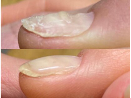 トイロネイルズ(toiro-nails)の写真