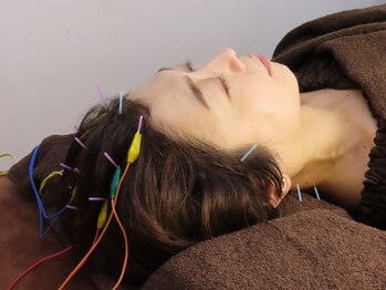 タピヨン 渋谷鍼療院(Tapiyon)の写真/【首肩コリ／腰痛／不眠／食いしばり等のお悩みに◎】最高級鍼を使用し、不調を徹底改善！美容鍼もご用意♪