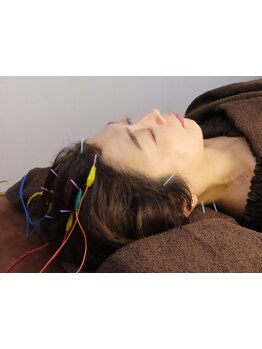 鍼灸施術を受けたい