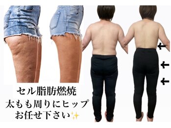ヨサパーク ポノン(YOSA PARK ponon)の写真/体重が落ちても変わらない…お困りの方必見≪下がったヒップ/太モモ回りのお肉≫を温活痩身で根本改善◎