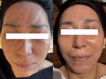 ジョーヌ(JAUNE)/お肌の駆け込み寺！