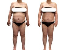 アイル(Isle)/食事制限&運動なし