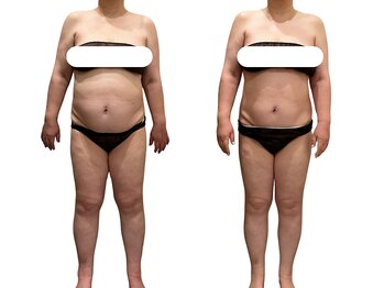 アイル(Isle)/食事制限&運動なし