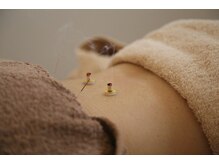 創健鍼灸院/鍼灸、種類豊富にそろえています