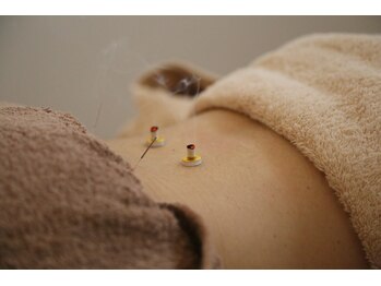 創健鍼灸院/鍼灸、種類豊富にそろえています