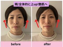 ケミー(Kmee)/小顔矯正☆ほぐれて整う美しさ