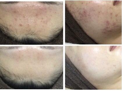 リラーナ(Re rana)の写真