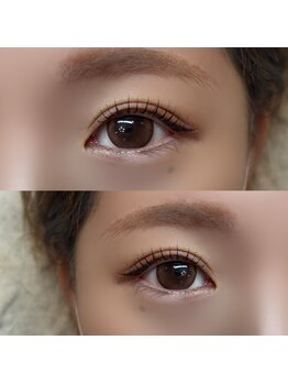 アンドユー(and.U)/