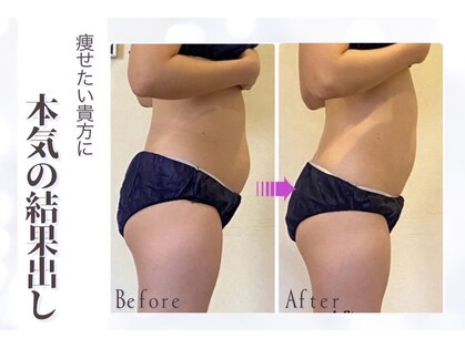 レヴェイユの写真