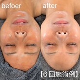 四季ビューティー(四季beauty)