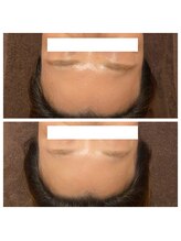 ビジュープラス 神栖店(Bijou+)/眉の歪みも一目瞭然