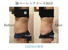 リープル(Leapl)/【腸もみ】腸もみ後の変化写真