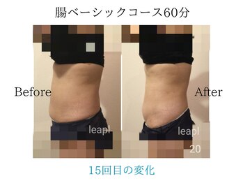 リープル(Leapl)/【腸もみ】腸もみ後の変化写真