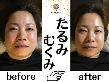 クレスト(CREST)/小顔矯正/頭蓋骨矯正/小顔コルギ