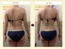 エステティックサロン ピュール ボーテ 東金店/ブライダルエステ