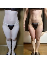 スリール(sourire)/ビフォーアフター