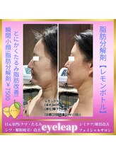 アイリープ(eyeleap)/☆レモンボトルビフォーアフター