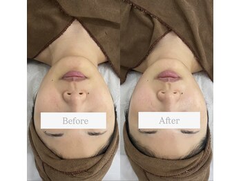 ビオラス 光吉店(VIOLUS)/筋膜リリース