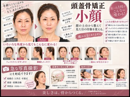 ムーブ(MOVE)の写真