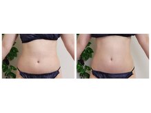 ティティビューティ ラ・クエージ金山(TTBeauty)/