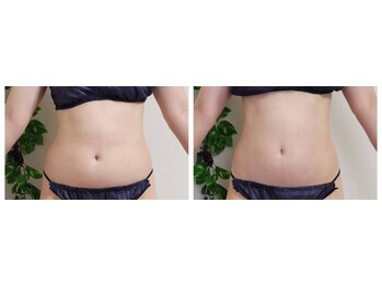 ティティビューティ ラ・クエージ金山(TTBeauty)/