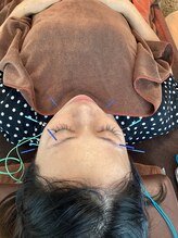 ハリファ鍼灸院 横浜関内院(HariFa鍼灸院)/美容施術