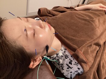 ハリファ鍼灸院 横浜関内院(HariFa鍼灸院)/美容施術/美容鍼