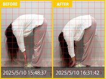 整体院 元 光の森店/腰痛、姿勢の悪さが悩み