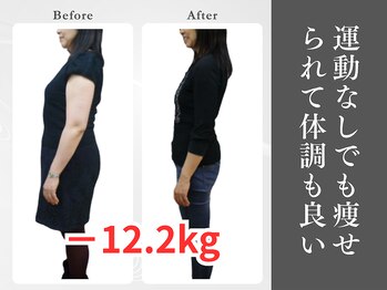 県庁通り整体院/運動なしでも痩せられた/痩身