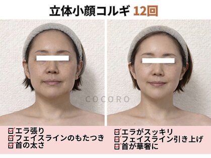 ココロ(COCORO)の写真