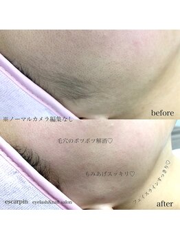 エスカルパン(escarpin)/フェイシャルWAX