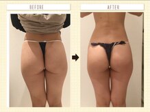 アレッタ 相模原/キュと引き締まった小尻に導く