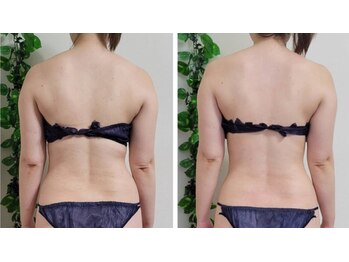 ティティビューティ ラ・クエージ金山(TTBeauty)/