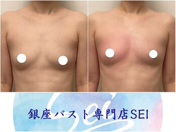 セイ(SEI)/before after