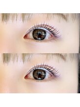 レスカ(Lesca)/ラッシュリフト