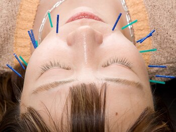 よしおか鍼灸整骨院/美容鍼