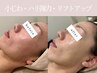 【たるみケア・小顔・肌弾力・二重顎】年齢悩みはコレ！エイジングピーリング