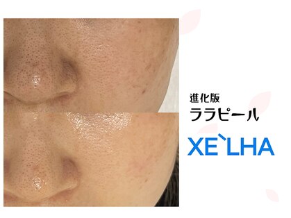ウララ(ulala)の写真