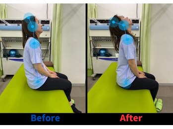 整骨院こころ 曙院/可動域の変化