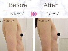 エムエムエム 表参道Luxeサロン(M.M.M)/【バストアップ例】　A→Cカップ