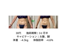 驚愕のビフォーアフター！