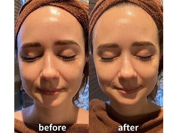 ラブ美長寿 沖縄本店(Lab)/ビフォーアフター光フェイシャル